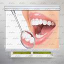 پرده شب و روز طرح دندانپزشکی کد BSN-07